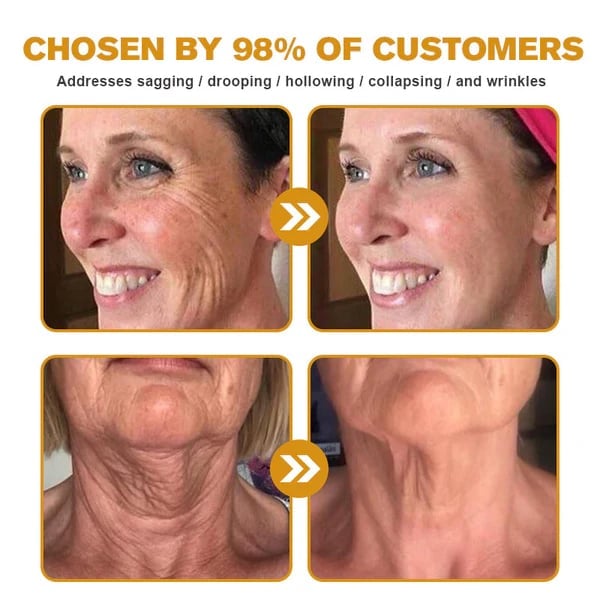 (Made and Shipped from USA) 🧑‍⚕️NEGUSY® Botox Bee Venom Wrinkle Removal Cream