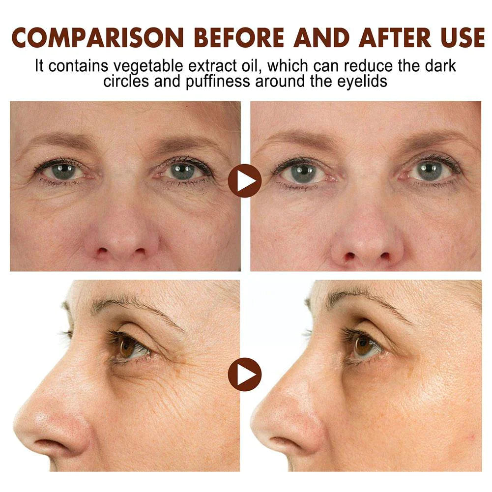 🔥2023 HOT SLAE🎁-Eyliss™ Crocodile Oil Anti-Aging Eye Cream