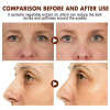 🔥2023 HOT SLAE🎁-Eyliss™ Crocodile Oil Anti-Aging Eye Cream