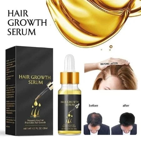 🔥Last Day Promotion 50% OFF🔥Biotin Thickening Herbal Serum - BUY 1 FREE 1