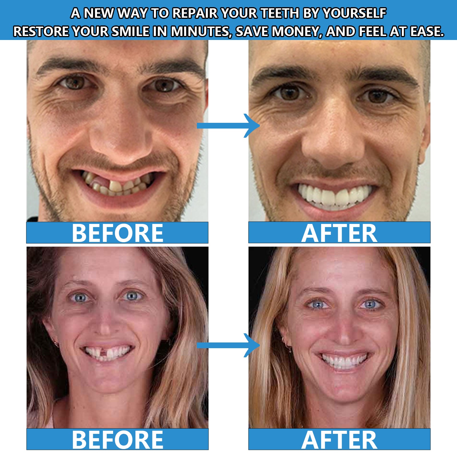 Clinclii™ Moldable False Teeth Restore Your Smile, Anytime. Anywhere