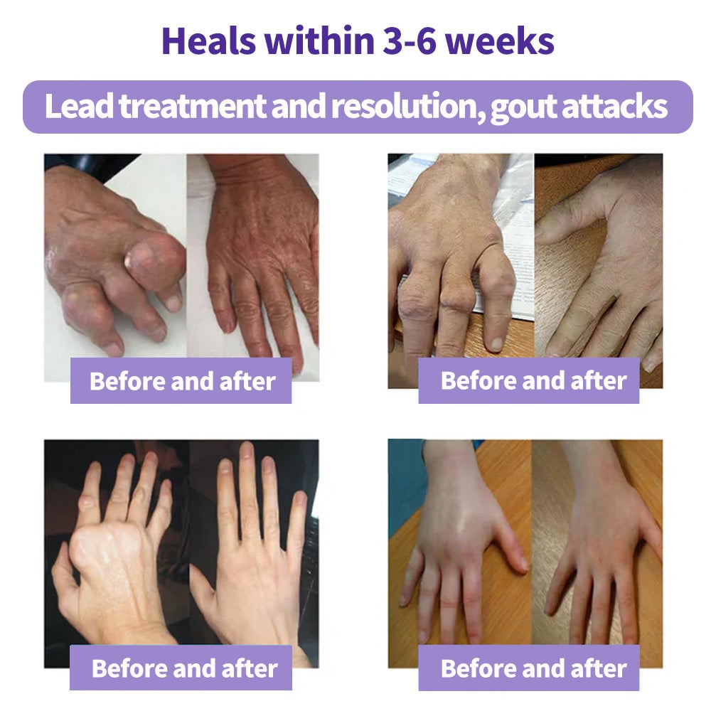 🔥Turmeric & Emu Oil Arthritis Soothing Pain Relief Massage Gel 👨‍⚕️Australian Osteopathic Association （AOA）Approved