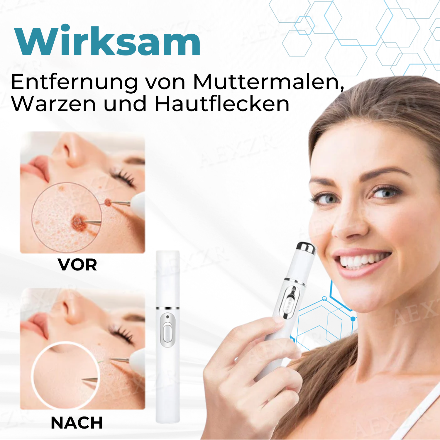 🎁-✨BENDCHARGE™ Nicht-invasiver Laser-Stift zur Entfernung von Muttermalen und Warzen✨