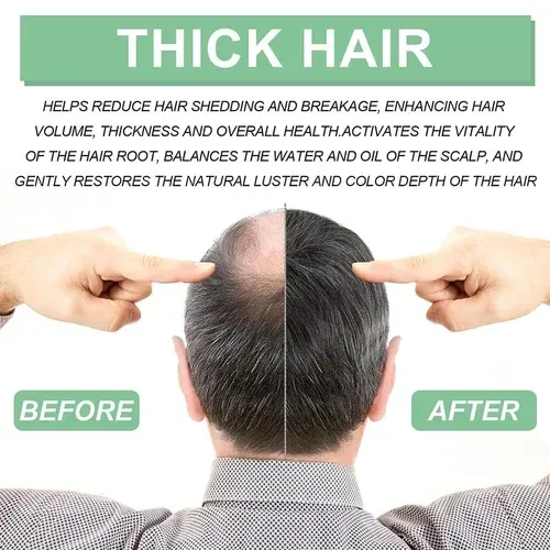 🔥Last Day Promotion 49% OFF - 🎁Renewhair X Roller Thick Hair Essential Oil