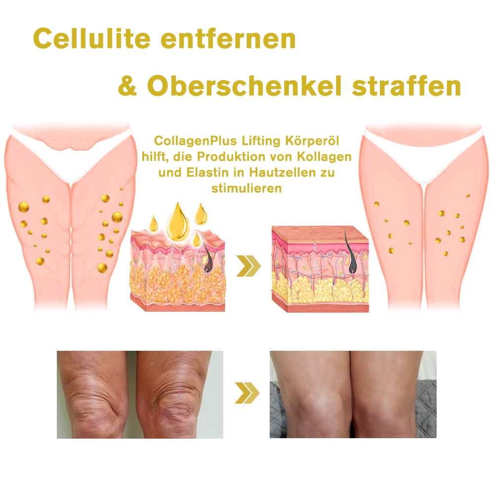 💗Dr. Smiths empfohlene Hautstraffungscreme - 60% Rabatt für eine begrenzte Zeit! 🛍️