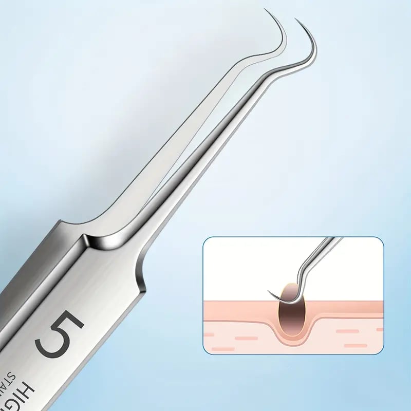 (⏰Last Day Promotion-60%OFF)Professional Facial Blackhead Remover Tweezers