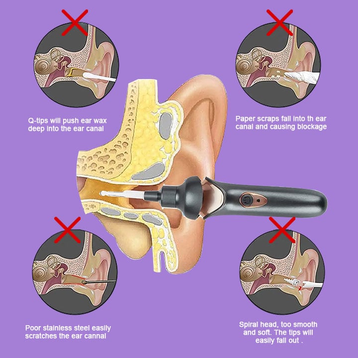 🎁2024 Stocking Stuffer🎁 Painless Ear Cleaning For The Whole Family