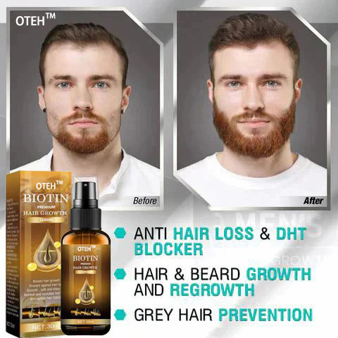 (🔥Last Day Sale-80% OFF) OTEH™ Biotin Premium Hair Growth Serum