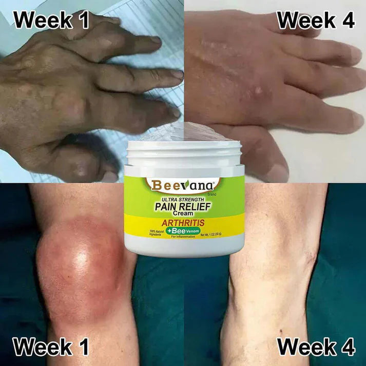 BENDCHARGE™ #1 Bee Venom Pain Relief Cream | (Pack Of 2)🔥