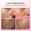 🔥Sonderangebote dieser Woche🔥Lumi Pore & Spot Care Duo