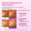 🔥Letzter Tag 49% Rabatt✨Klare‑Haut Pflege‑Duo