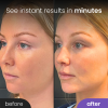 🔥LAST DAY PROMOTION 70% OFF💥Define™ Beauty Sculptor