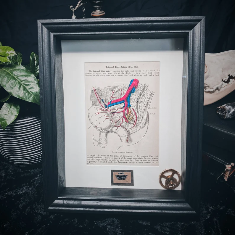 Lobotomy Shadowbox Display