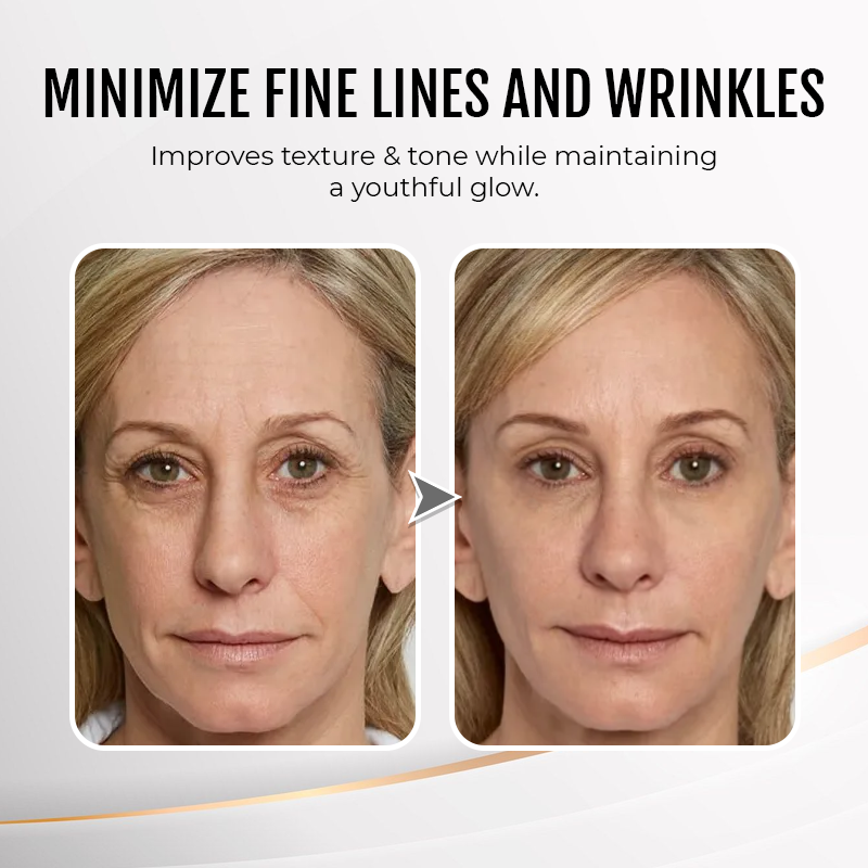 🔥Last Day Discount: 70% OFF - Upgraded Instant Wrinkle Eye Tightener cream