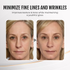🔥Last Day Discount: 70% OFF - Upgraded Instant Wrinkle Eye Tightener cream