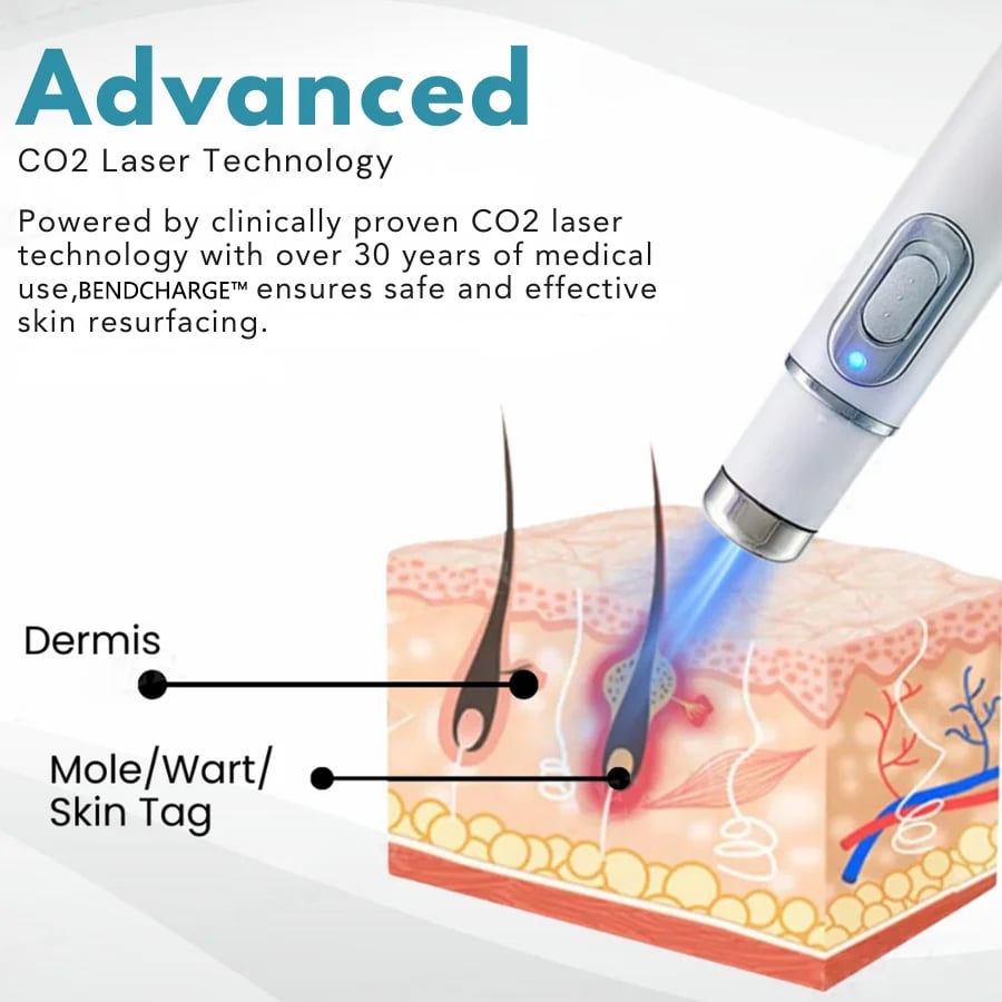 BENDCHARGE™ Non-Invasive Mole and Wart Removal Laser Pen