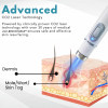 BENDCHARGE™ Non-Invasive Mole and Wart Removal Laser Pen