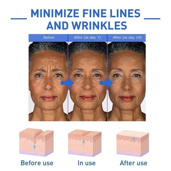 Last Day Promotion 49% OFF - 🔥2023 New Botox Face Serum