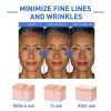 Last Day Promotion 49% OFF - 🔥2023 New Botox Face Serum