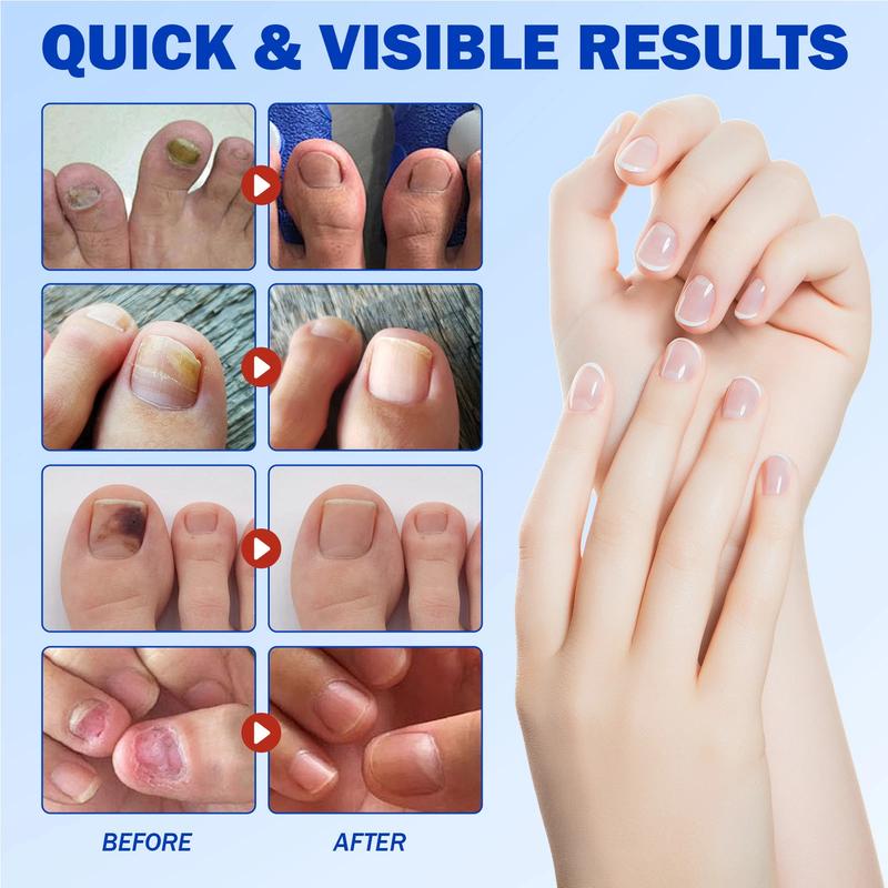 🔥LAST DAY ONLY 50% OFF🔥21 Pcs Fungal Nail Patches⚡BUY 3 GET 1 FREE