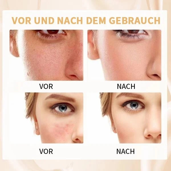 🔥Heißer Verkauf🔥Kaufen Sie 1, erhalten Sie 3 kostenlos💥Beste farbwechselnde Foundation für reife Haut