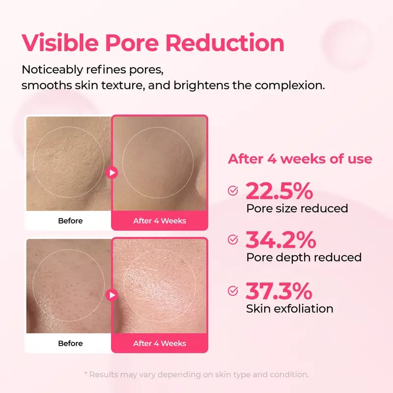 🔥LAST DAY SALE 50% OFF🔥Pore & Spot Care Duo