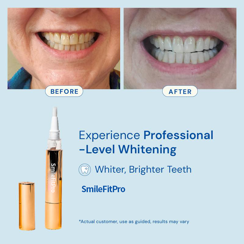 Extra-strength Teeth Whitening serum Pen