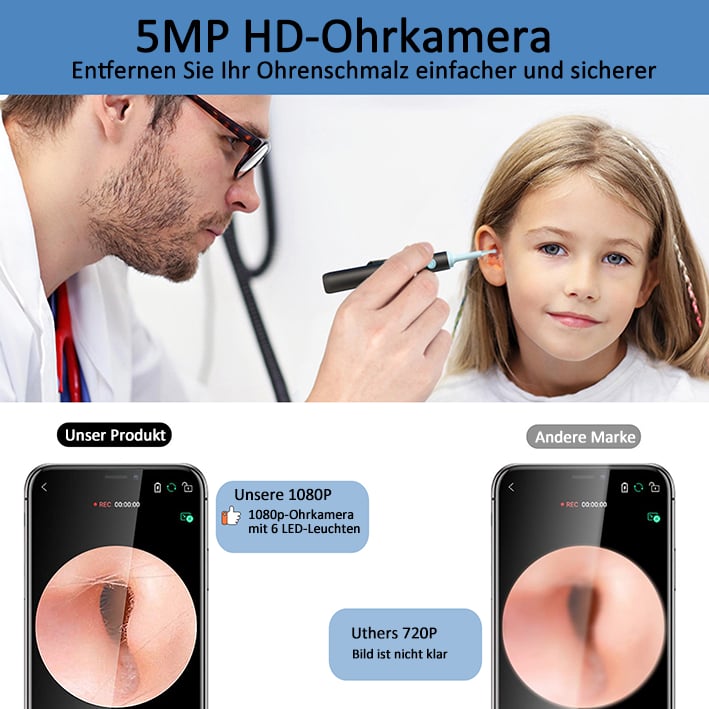 Ohrschmalz-Entfernungsset mit HD-Kamera