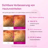 🔥Sonderangebote dieser Woche🔥Lumi Pore & Spot Care Duo