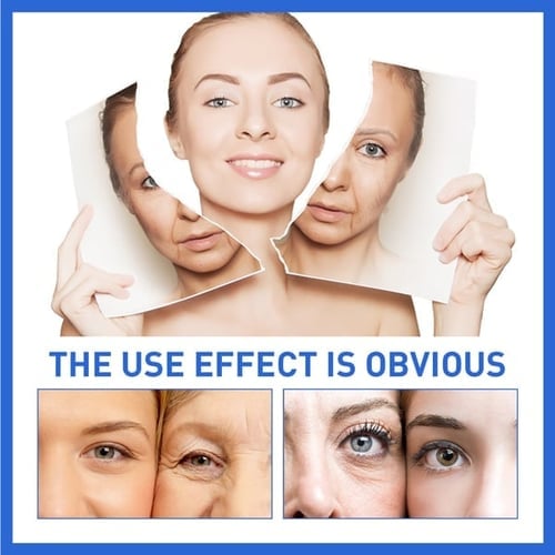 Last Day Promotion 49% OFF - 🔥2023 New Botox Face Serum