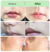 🔥Last Day 50% OFF - Hair Removal Cream Kit for Women⚡BUY 2 GET 1 FREE