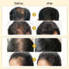 🔥LAST DAY 50% OFF 🔥PURC Hair Regrowth Treatment - Anti Hair Loss & Hair Growth