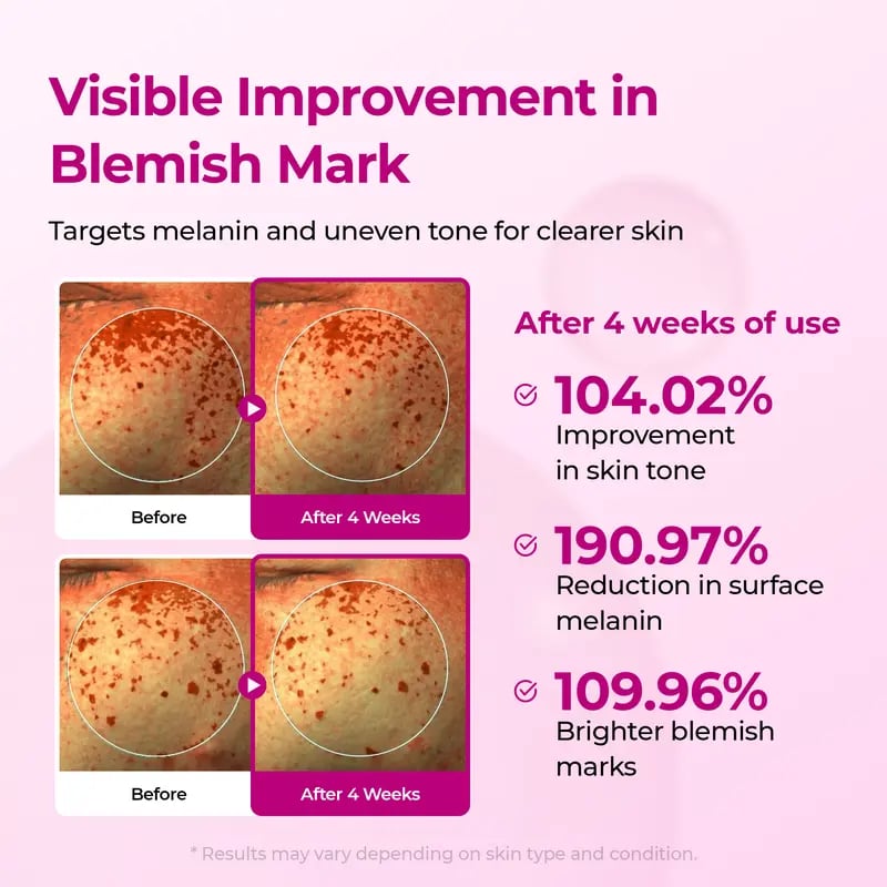 🔥LAST DAY SALE 50% OFF🔥Pore & Spot Care Duo