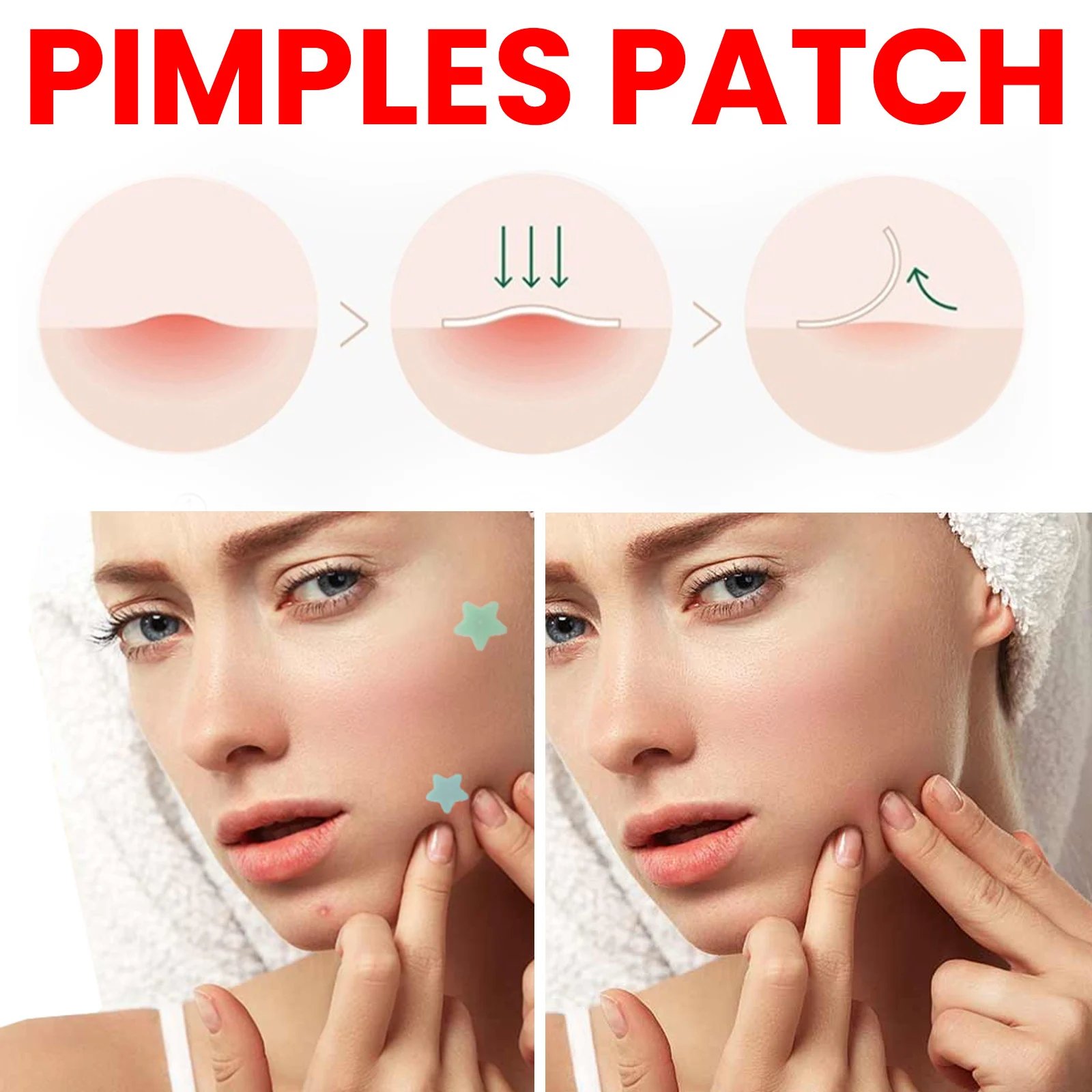 🔥Last Day 70% OFF🔥Star-Shaped Acne Patches⭐✨