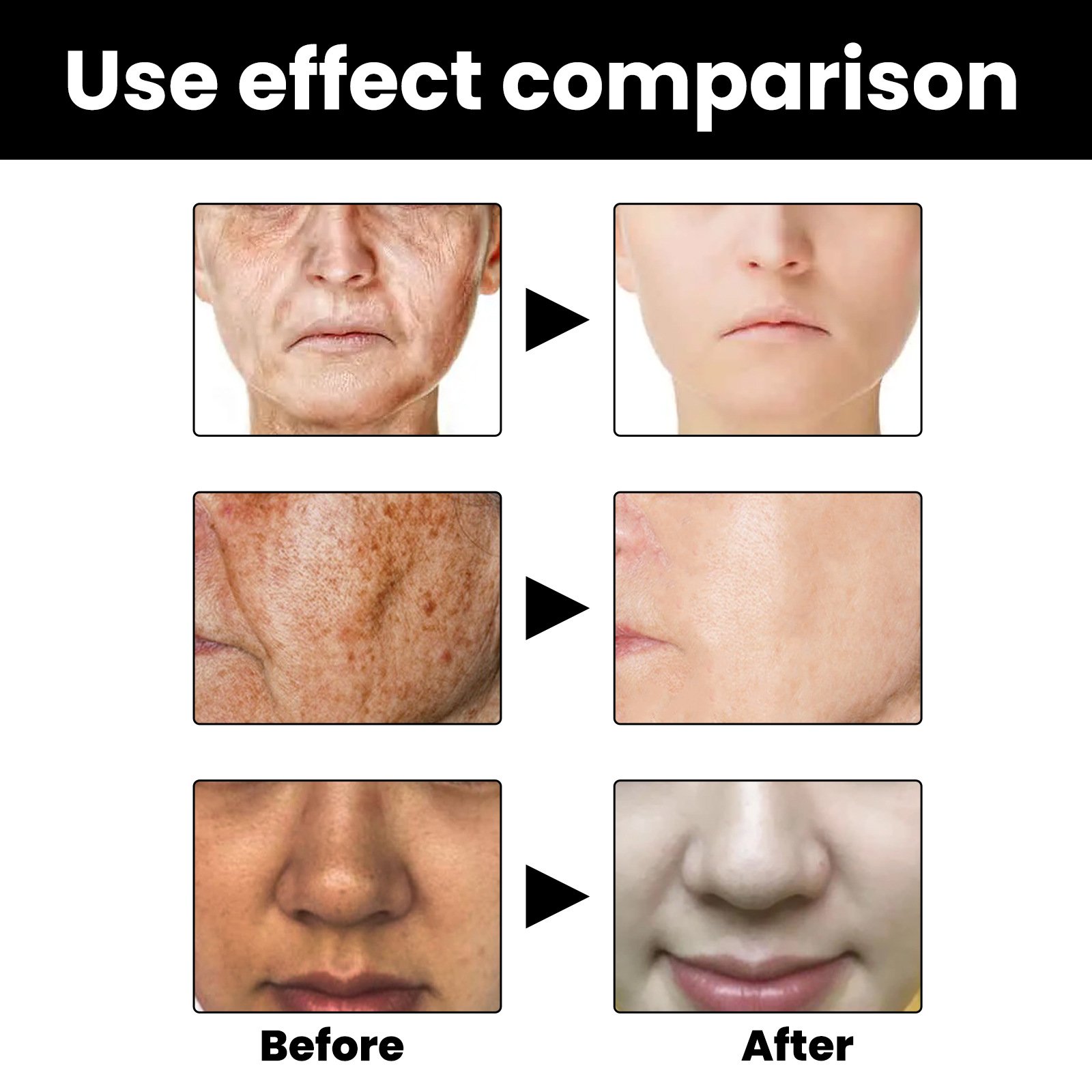 Last Day Promotion 49% OFF - 🔥2023 New Botox Face Serum