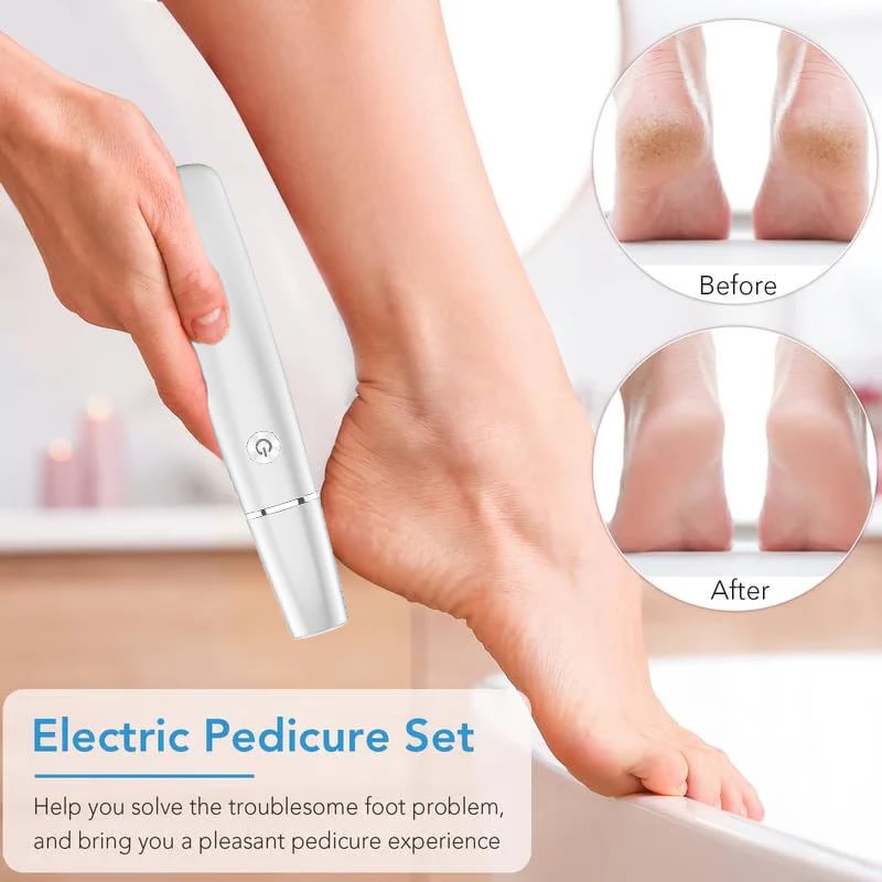 🔥Last Day Promotion 50% OFF💥Electric Feet Callus Remover