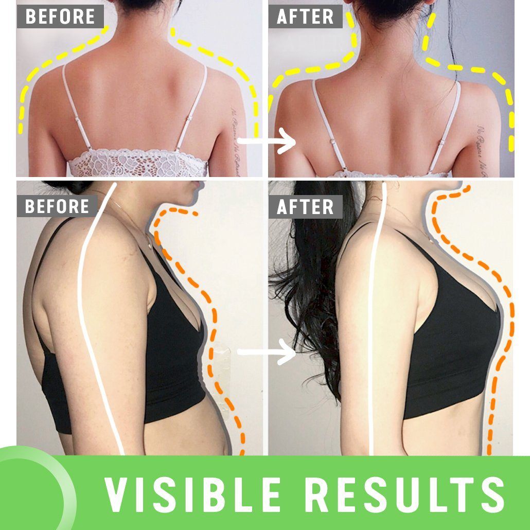 🔥🔥HOT SALE -Invisible Back Posture Orthotics（⚡Buy 2 Free Shipping Now!）