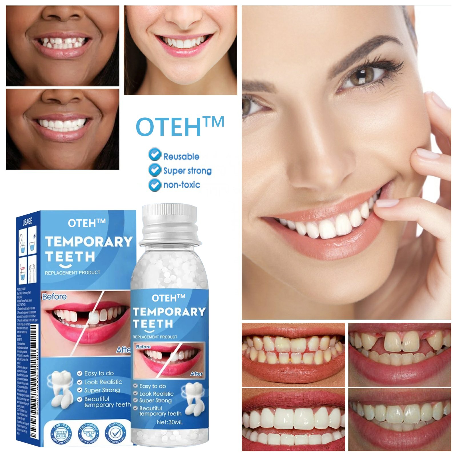 OTEH™ – The Ultimate Temporary Tooth Repair Solution for a Perfect Smile