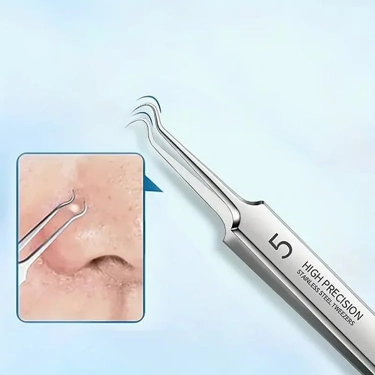 💥LAST DAY SALE 49% OFF💥Professional Facial Blackhead Remover Tweezers