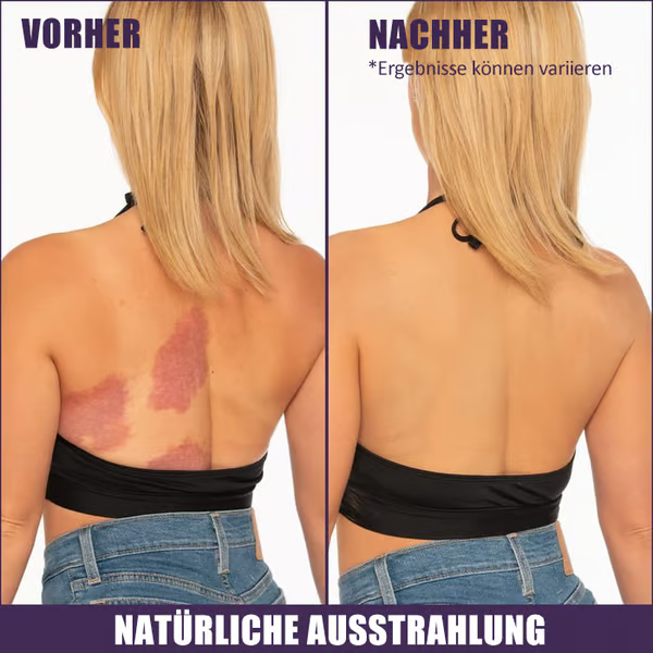 🔥LETZTER TAG 49 % RABATT🌟Körper-Concealer-Perfektionscreme – Feuchtigkeitsspendend, langanhaltend, leicht und wasserfest, 4 in 1💧✨