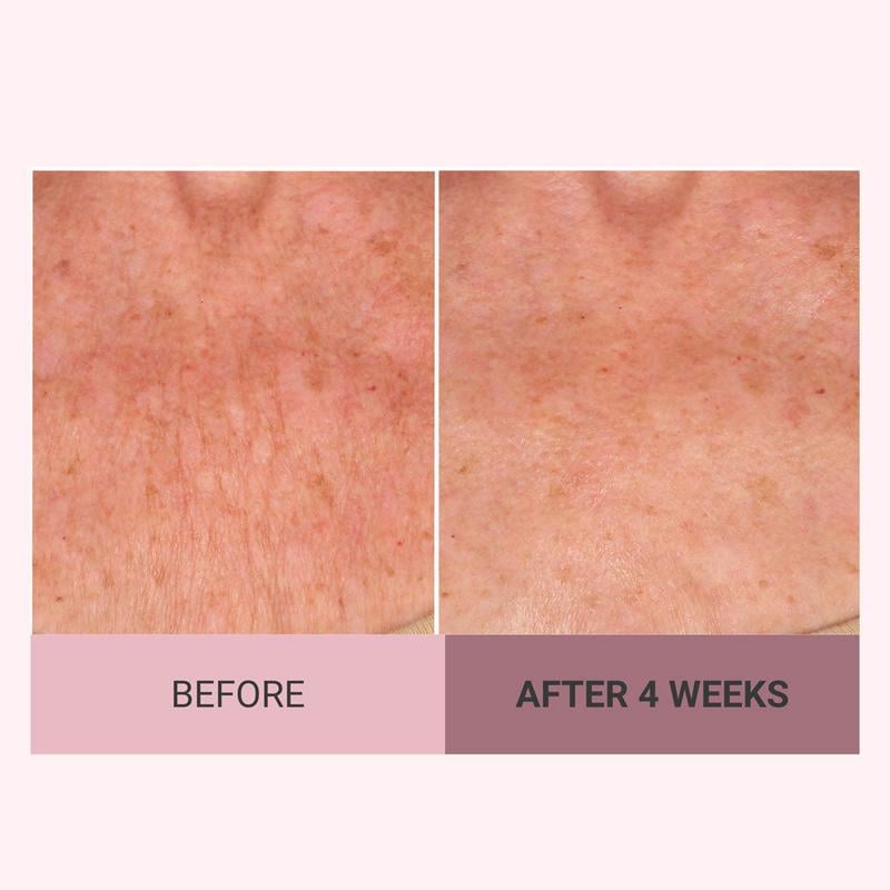 🎁TikTok Last Day Sale - 70% OFF🎉Consult Beaute Champagne Beaute Lift Firming Body Crème