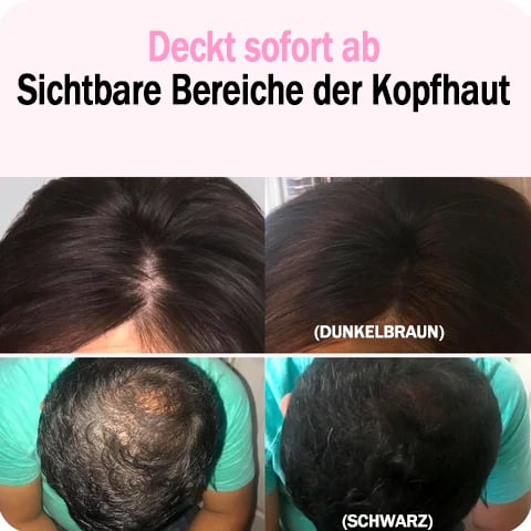 🔥Letzter Tag 49% Rabatt 💕Das perfekte Werkzeug zum Auffüllen des Haaransatzes
