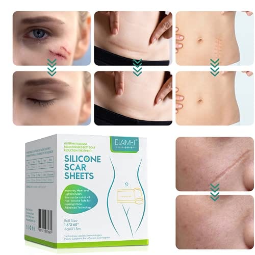 🔥Last Day Promotion 70% OFF-🔥-ELAIMEI  self-adhesive silicone scar patch