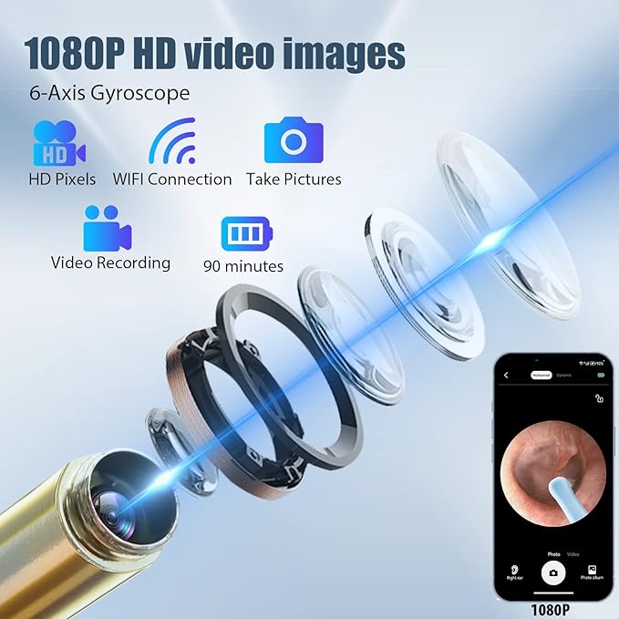 (🎅Early Xmas Offer 1000pcs 50% OFF) Wi-Fi visible Ear Wax Removal, USB 1080P HD load otoscope