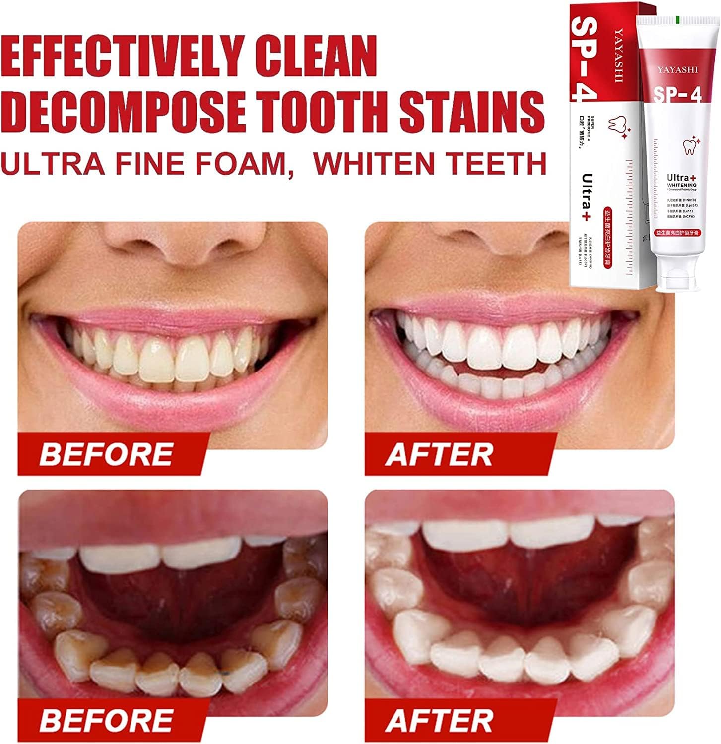 Probiotic Whitening Toothpaste - Removes Years of Stains