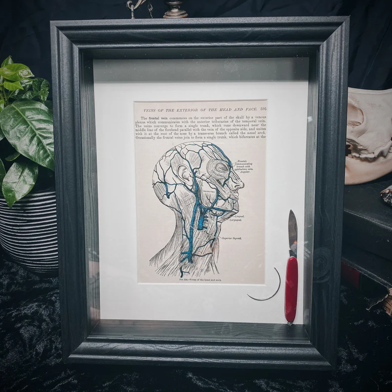 Lobotomy Shadowbox Display