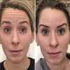 Last Day Promotion 49% OFF - 🔥2023 New Botox Face Serum