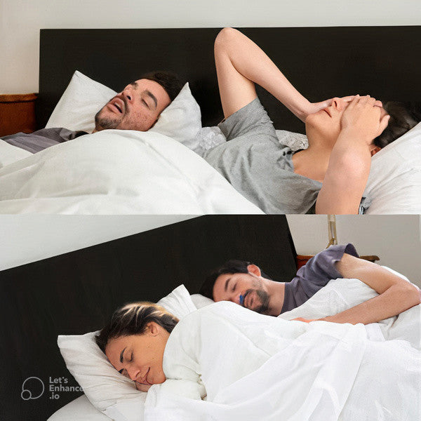 💝2023 Father's Day Save 48% OFF🎁Anti-Snoring Device