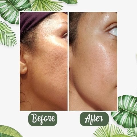 ✨Free shipping-Last Day 75% OFF 🔥-🍵 Deep Cleanse Green Tea Mask