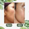 ✨Free shipping-Last Day 75% OFF 🔥-🍵 Deep Cleanse Green Tea Mask